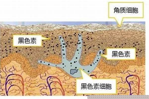 黑色素部分缺失